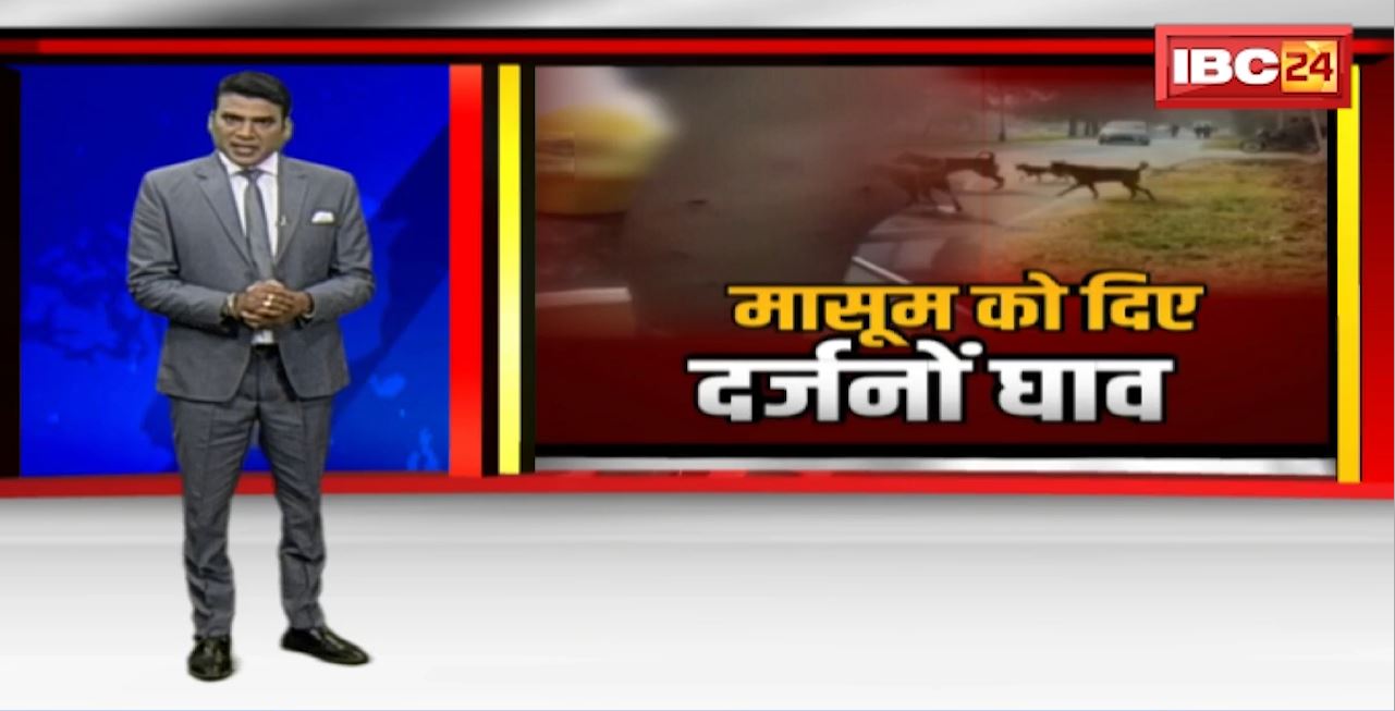 Singrauli में आवारा कुत्तों का आतंक। कुत्तों के हमले में बच्चा गंभीर रुप से घायल
