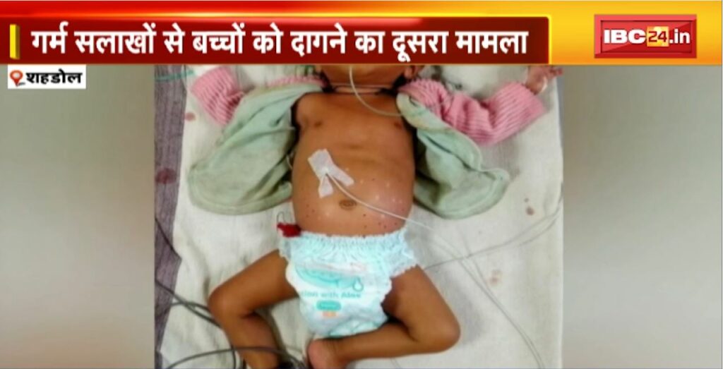 Innocent died due to superstition in Shahdol