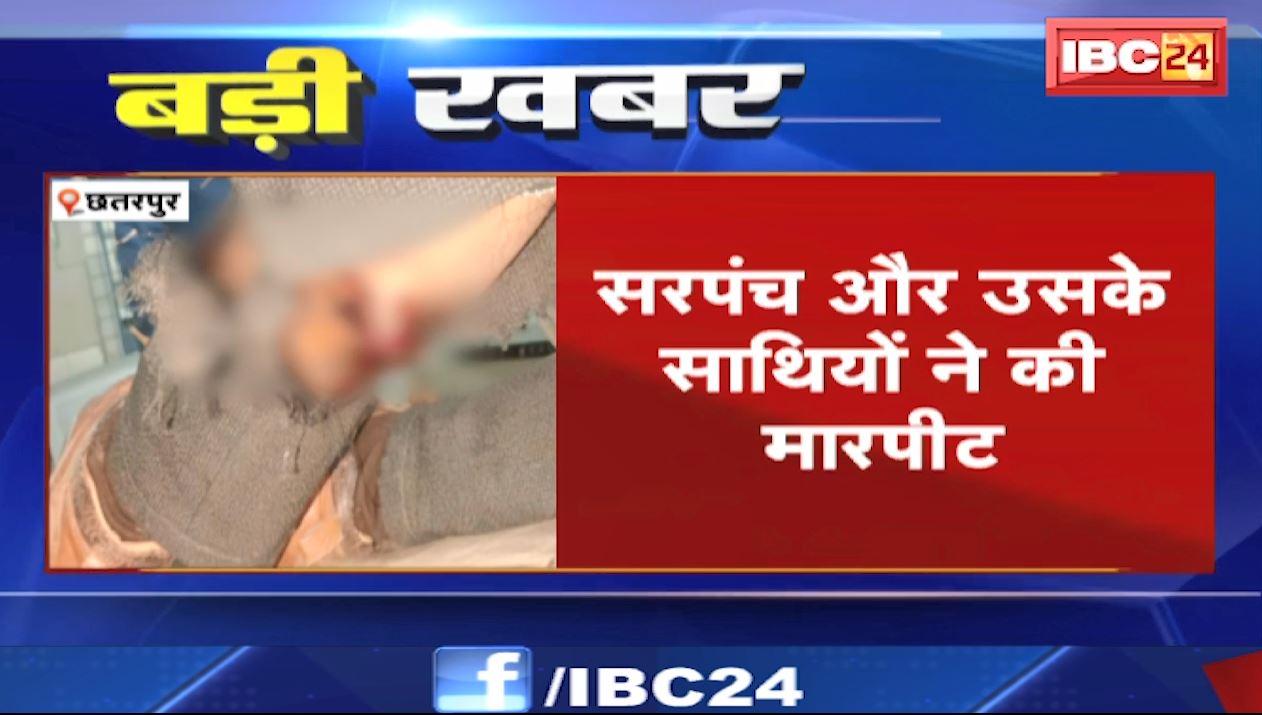 सरपंच ने साथियों के साथ मिलकर पंचायत सचिव के साथ की मारपीट। पुरानी रंजिश में सरपंच ने मारी गोली..
