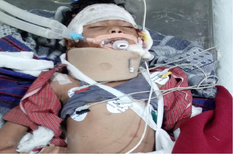 Bhanupratappur: भानुप्रतापपुर हादसे की वजह से एक और बच्चे की हुई मौत, मरने वालो की संख्या बढ़कर हुई 8