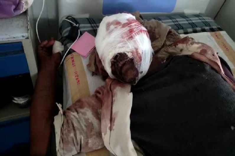 Chhatarpur news: खेत की रखवाली कर रहे बुजुर्ग के साथ घटी खौफनाक घटना, चेहरे और आंखों में आई गंभीर चोटें, जानें मामला