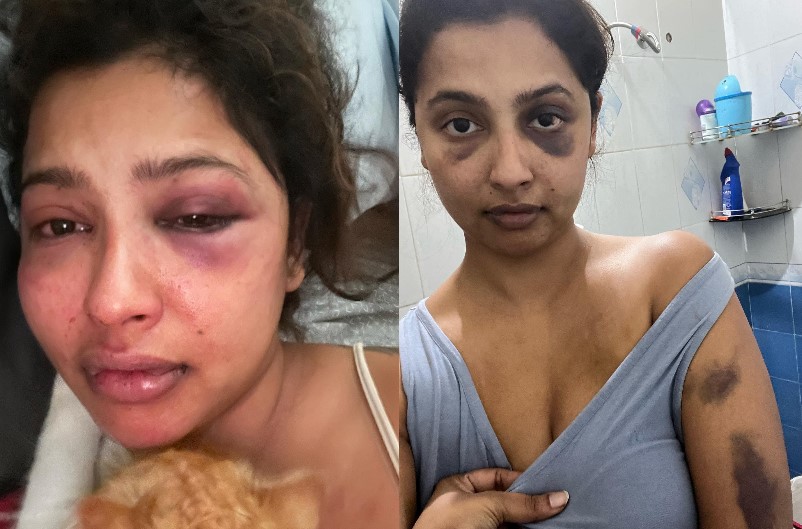 Actress Anicka Vikhraman assault