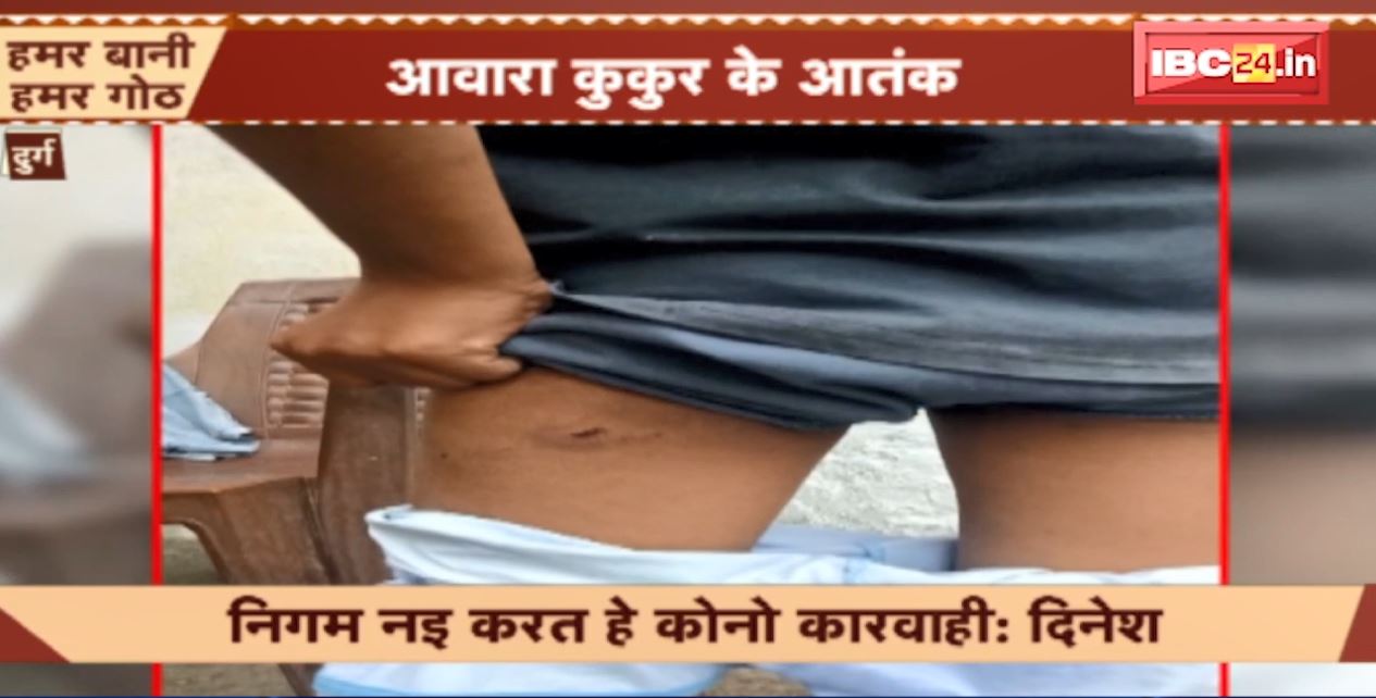 दुर्ग में आवारा कुत्तों का आतंक। गया नगर इलाके में एक दिन में कुत्तों ने 8 लोगों को काटा। देखिए..