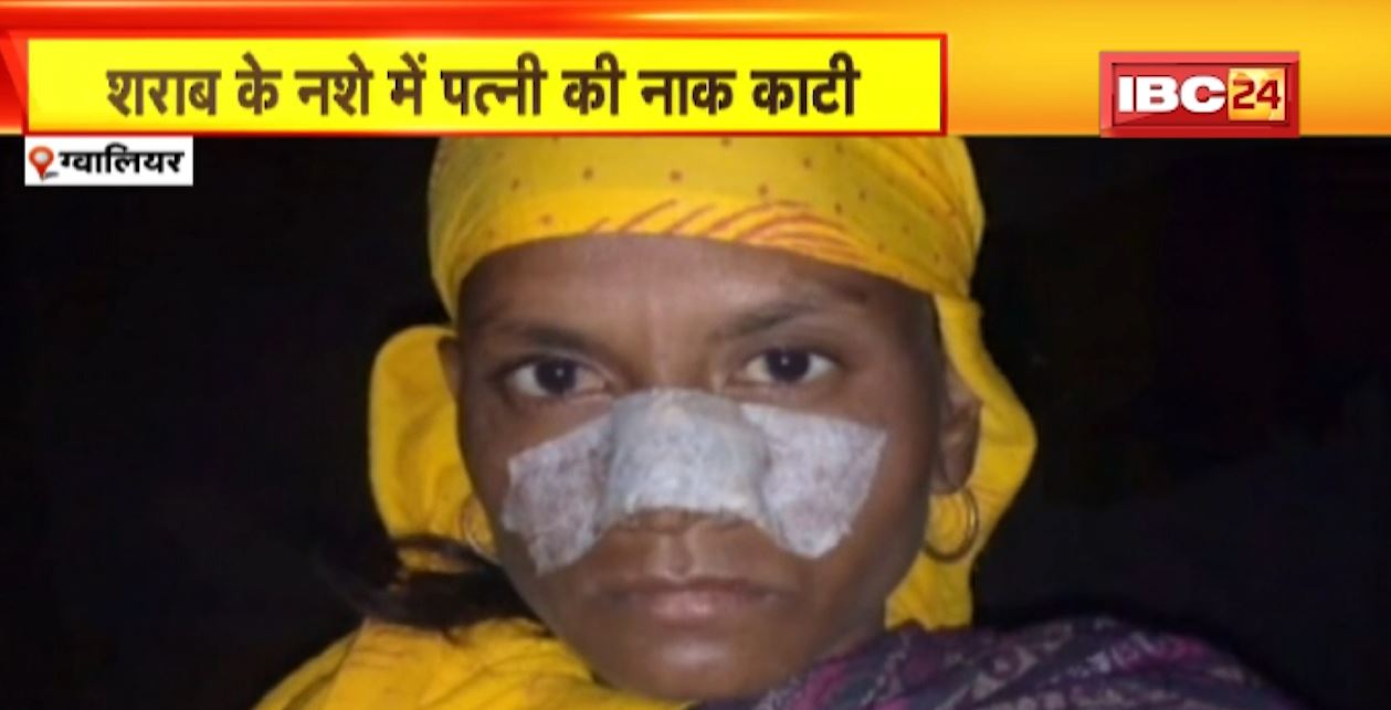 शराब के नशे में पति ने काट दी पत्नी की नाक। मायके जाने की बात कहने पर पति ने किया हमला। ग्वालियर के घाटीगांव का मामला