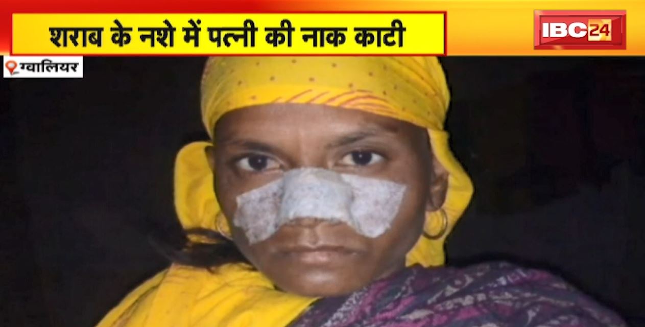 शराब के नशे में पत्नी की नाक काटी | मायके जाने की बात कहने पर किया हमला | देखिए पूरी Report