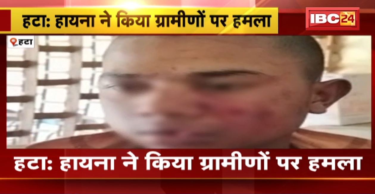 हटा में हायना ने ग्रामीणों पर किया हमला। हमले में 3 ग्रामीण घायल। देखिए..