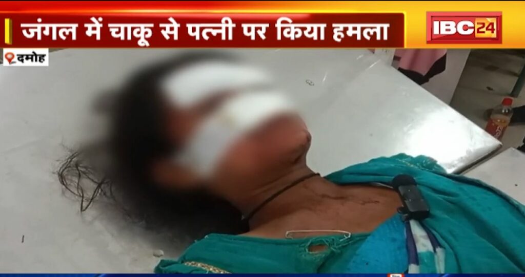 In Damoh, husband cut off wife's eyes and nose