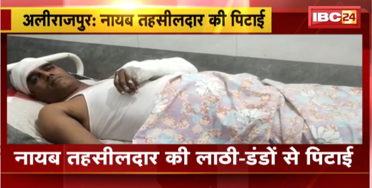 Alirajpur : नायब तहसीलदार की लाठी-डंडों से पिटाई। नामांतरण को लेकर आरोपी ने की पिटाई