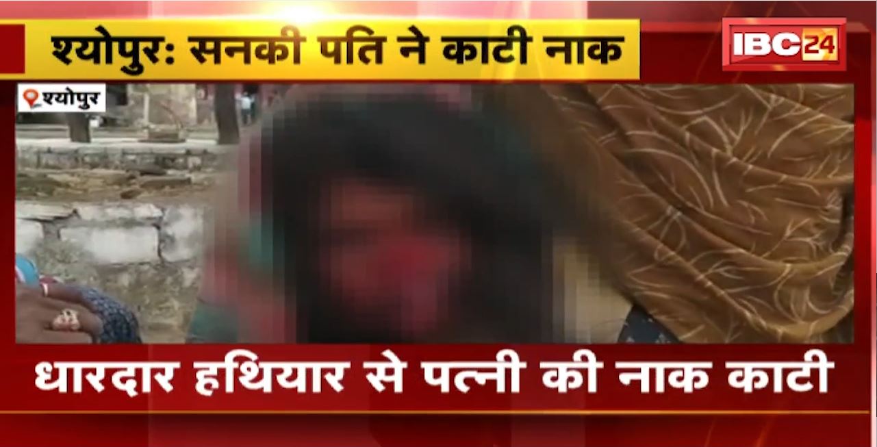 Sheopur Crime News : धारदार हथियार से पत्नी की नाक काटी। खेत में काम करते समय हुआ था विवाद