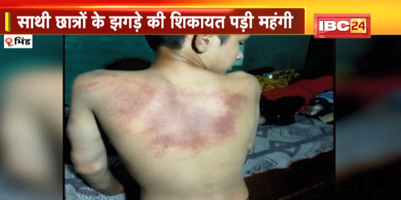 साथी के झगड़े की शिकायत युवक को पड़ी महंगी। टीचर ने शिकायत करने वाले छात्र को बेल्ट निकालकर बेरहमी से पीटा। देखिए वीडियो..