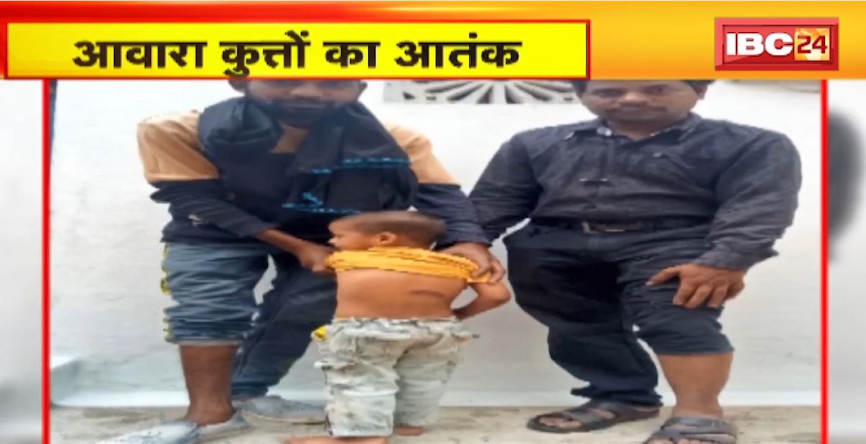 आवारा कुत्तों का आतंक | Durg के गया नगर में एक दिन में Dog Bites के 8 Case