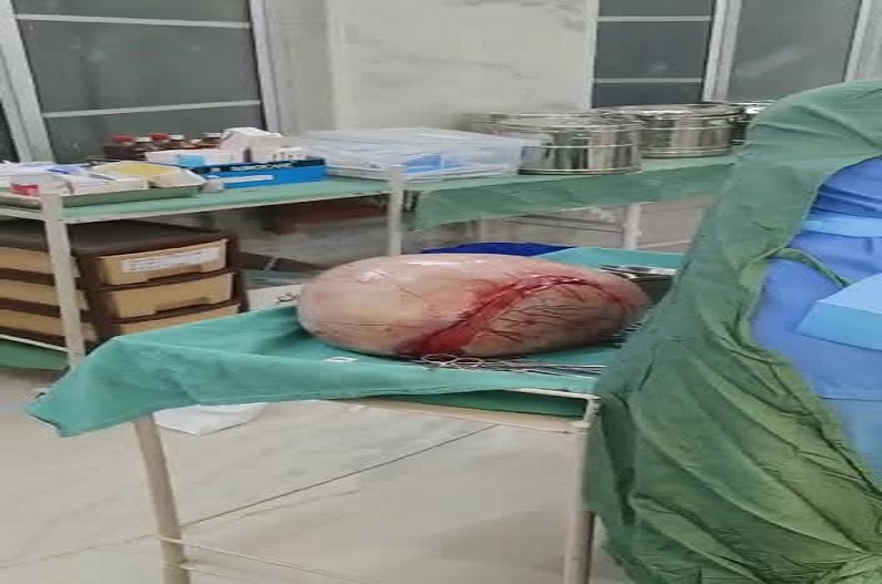 10 kg meat ball came out from the stomach of a troubled woman for five years