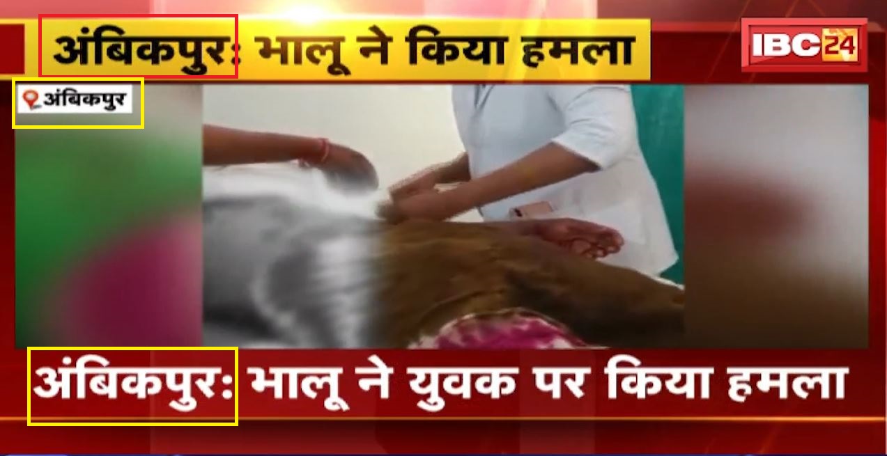 अंबिकापुर में भालू ने युवक पर किया हमला। भालू के हमले से  युवक गंभीर रूप से घायल। देखिए..
