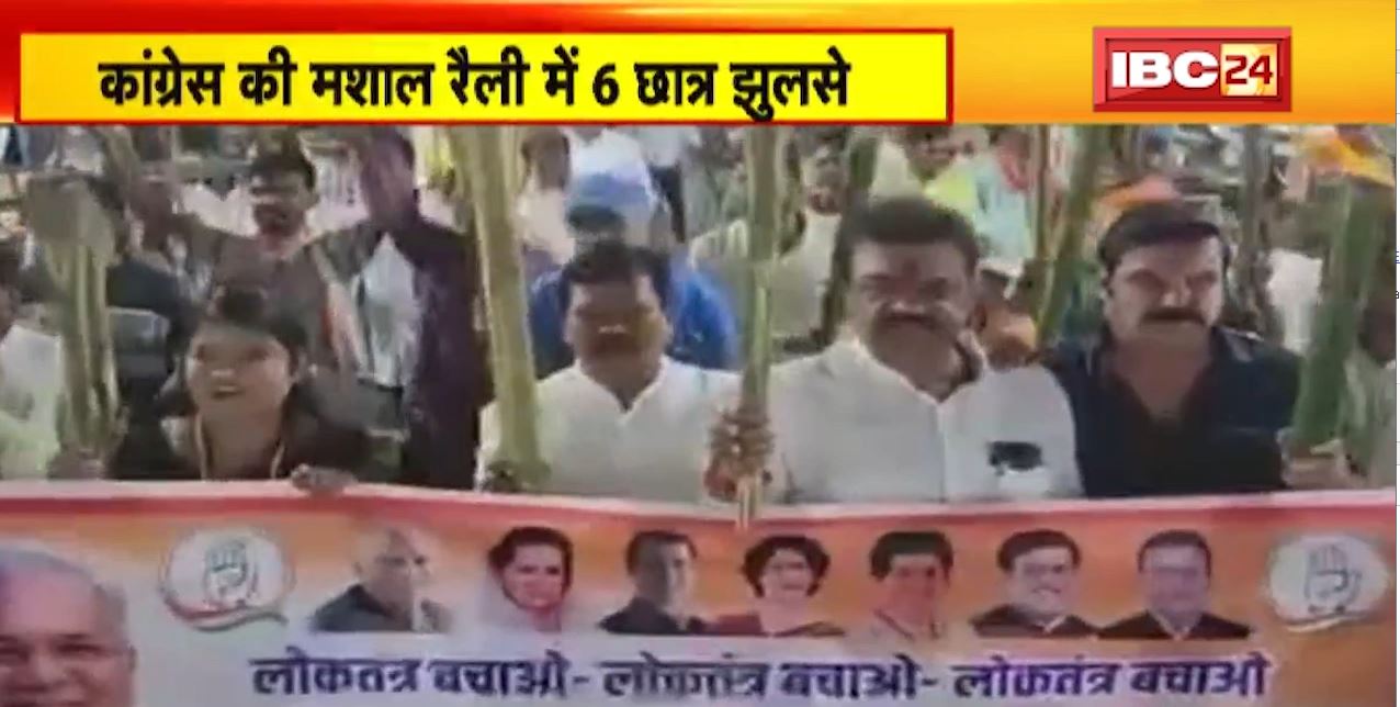 कांग्रेस की मशाल रैली में झुलसे 6 छात्र। BJP हुई हमलावर, कहा- रैली में छात्रों का इस्तेमाल करना गंभीर विषय