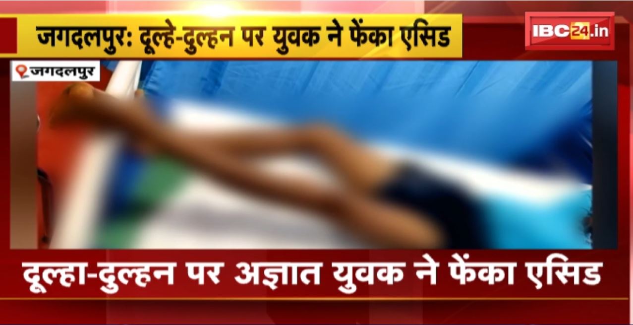 Jagdalpur Acid Attack : दूल्हा-दुल्हन पर अज्ञात युवक ने फेंका एसिड। शादी समारोह में वारदात को दिया अंजाम