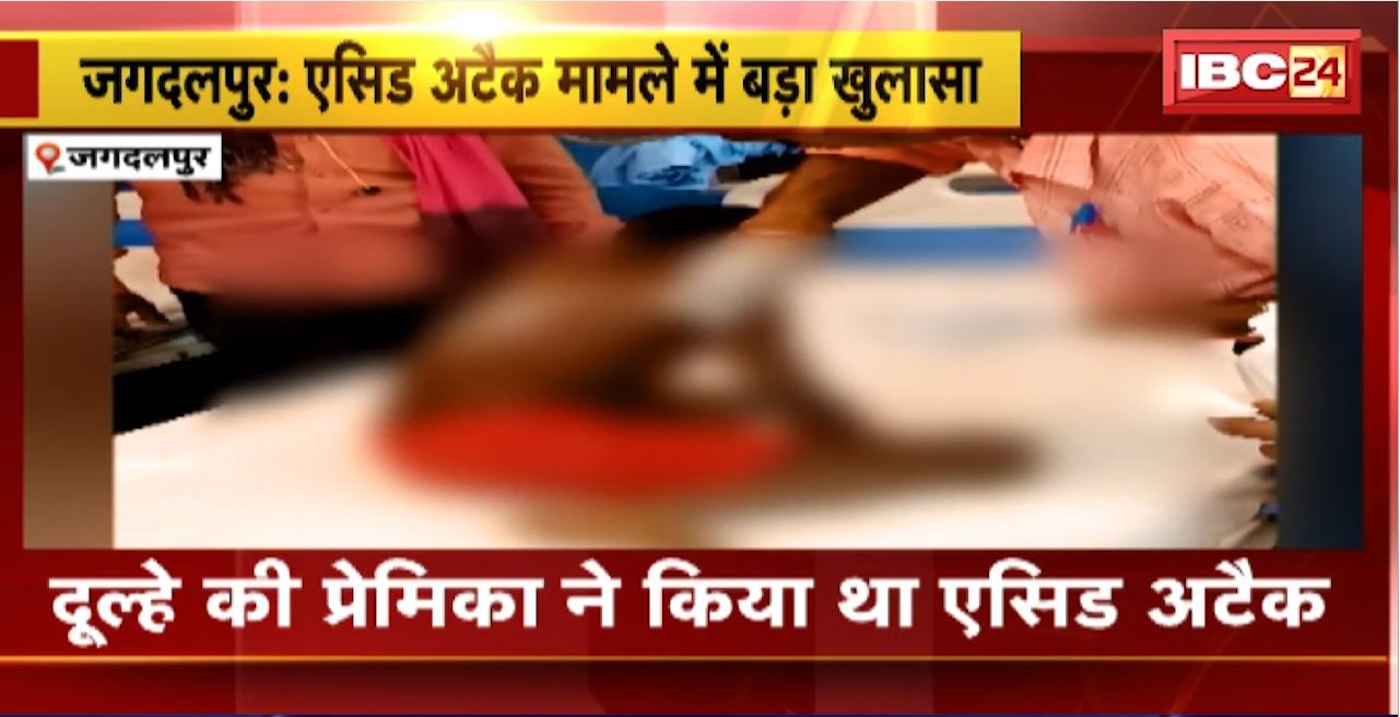 jagdalpur Acid Attack Case : दूल्हे की प्रेमिका ने किया था एसिड अटैक। Police ने युवती को किया Arrest