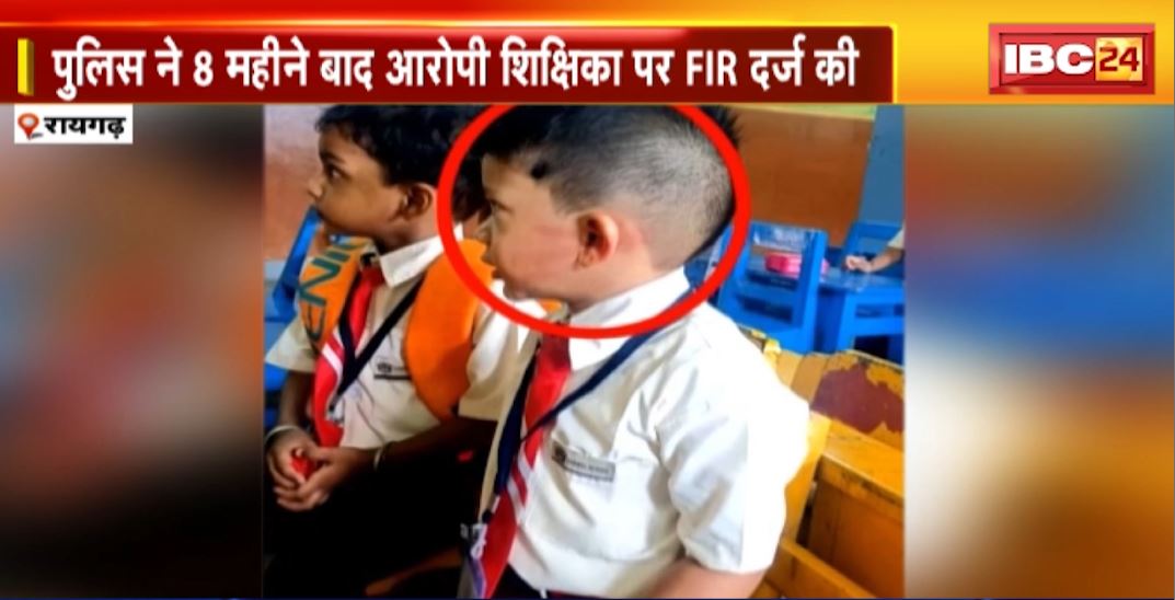 8 महीने बाद थप्पड़ की गूंज! नर्सरी के बच्चे को थप्पड़, Police ने 8 महीने बाद आरोपी शिक्षिका पर FIR दर्ज की