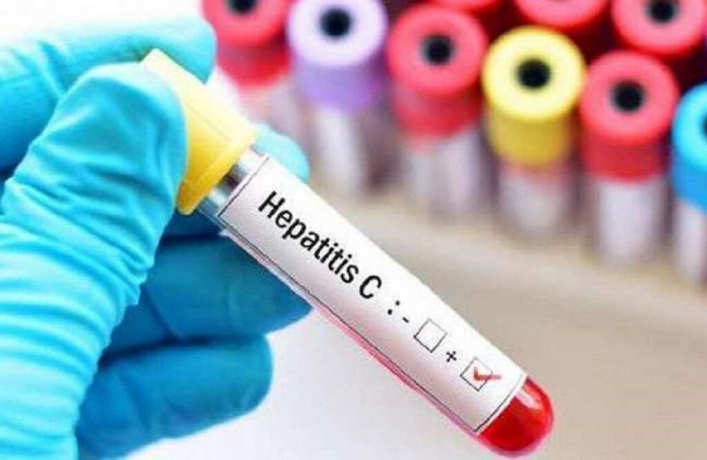 Hepatitis-C patients are continuously increasing in the villages of Kharora Tehsil area