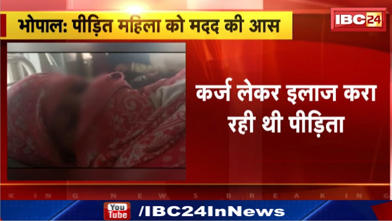 Bhopal News : ससुराल वालों ने लोहे की गर्म राड से महिला के पूरे शरीर को दागा | कर्ज लेकर इलाज करा रही पीड़िता