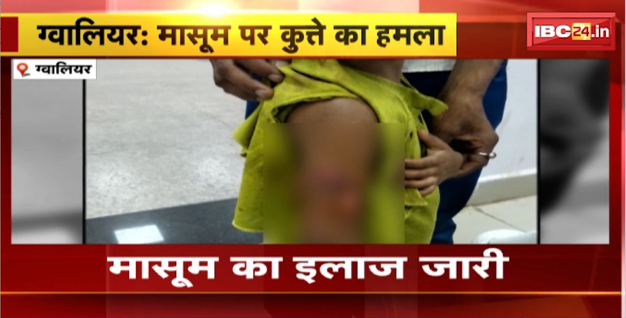ग्वालियर में 5 साल की बच्ची पर कुत्ते ने किया हमला। आवारा कुत्ते के हमले से मासूम जख्मी