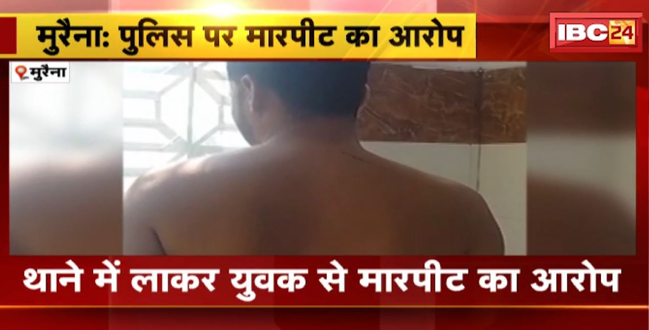 CM हेल्पलाइन में शिकायत करना युवक को पड़ा भारी। पुलिसकर्मियों ने युवक को घर से उठाया, थाने में युवक से मारपीट का आरोप। देखिए..
