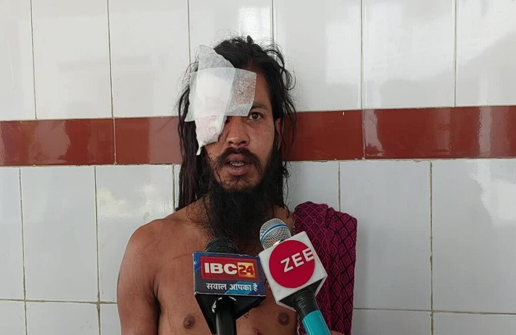 Unknown thieves escaped after beating Sadhu Baba and snatching Rs 22,500 cash