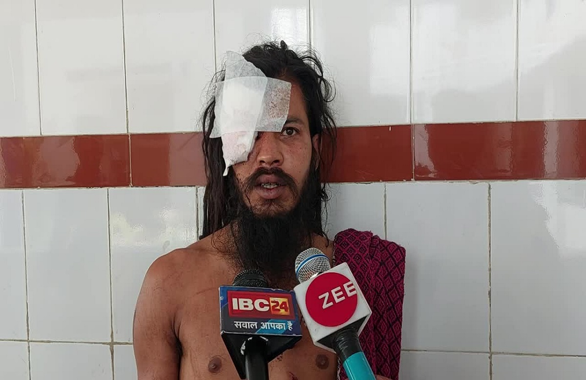 Khargone News: आश्रम के साधु बाबा की जमकर पिटाई, सिर-हाथ और छाती में आई गहरी चोटें, जानें माजरा
