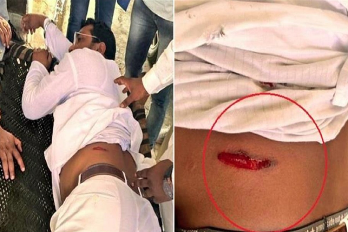 भीम आर्मी चीफ चंद्रशेखर रावण पर जानलेवा हमला, UP में मारी गई गोली, भेजे गए अस्पताल