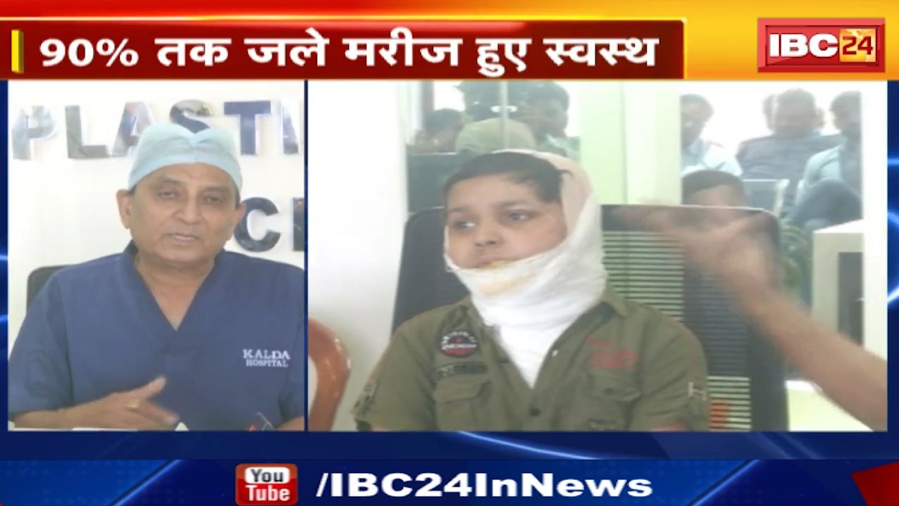 Kalda Burn & Plastic Surgery Center – Raipur : 5 बच्चों को मिली नई जिंदगी | 90% तक जले मरीज हुए स्वस्थ