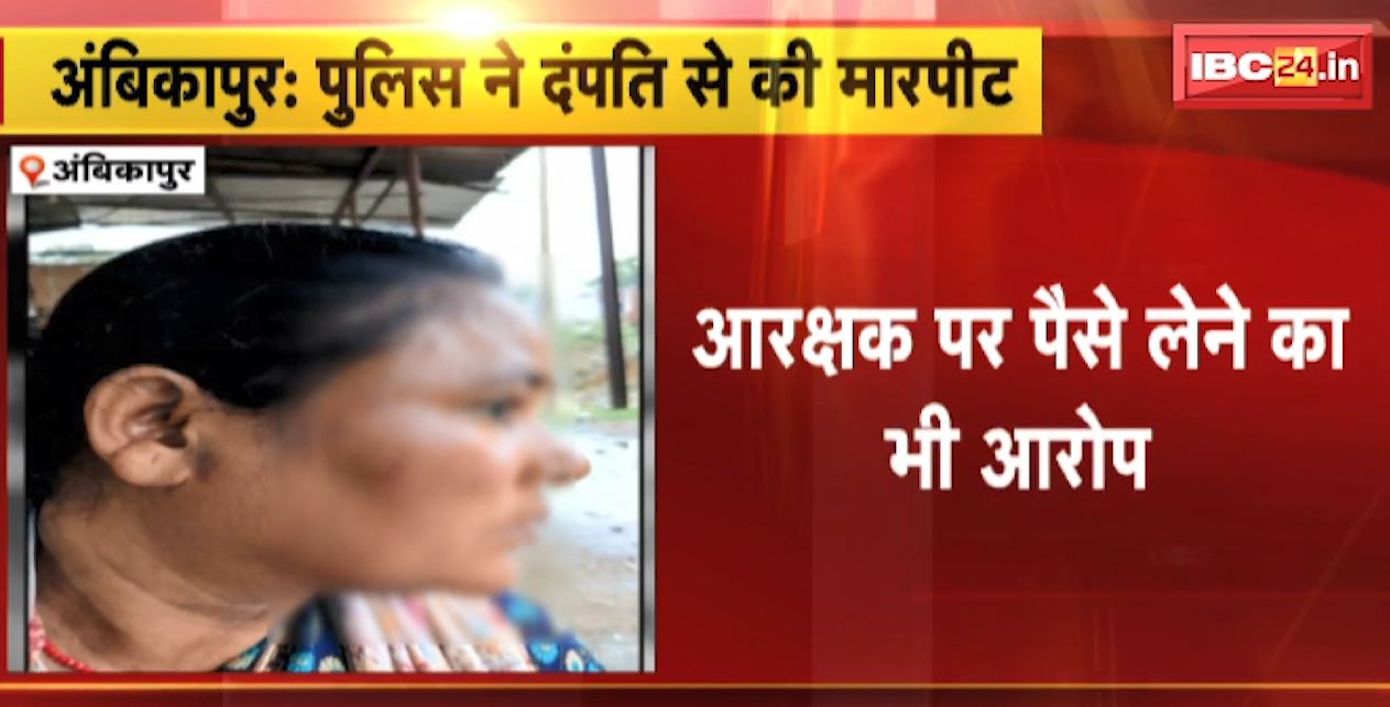 Ambikapur News : Police ने दंपति से की मारपीट | पीड़ित महिला ने SP से की शिकायत