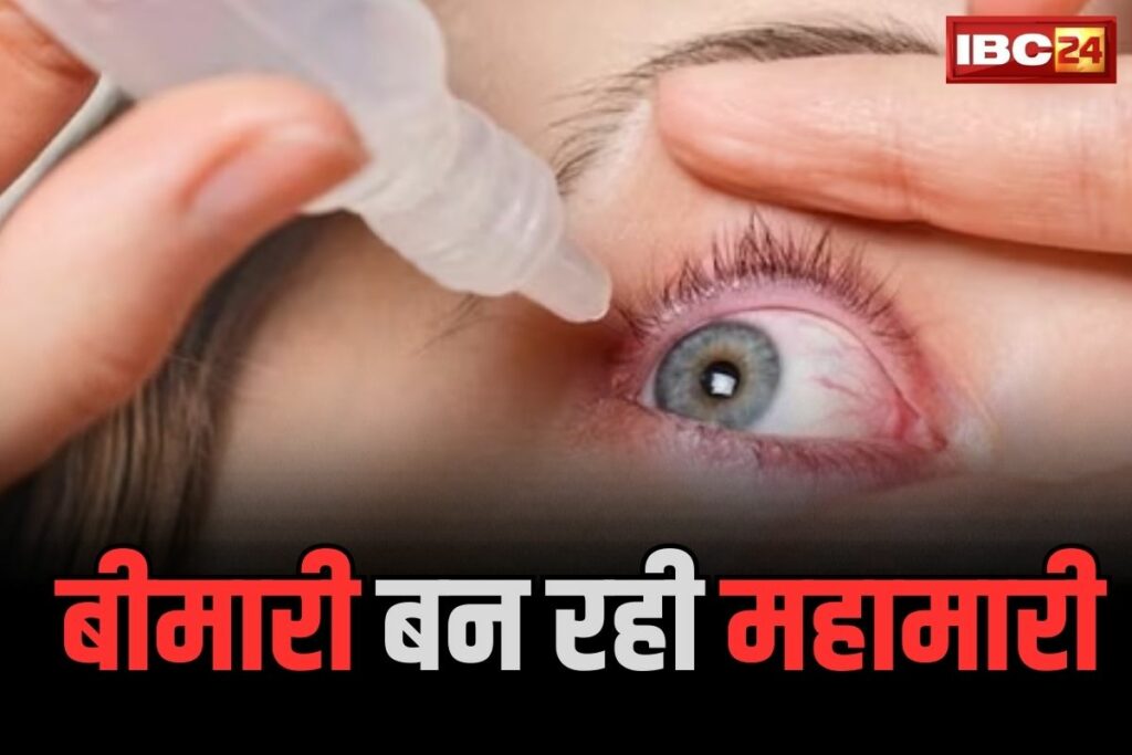 Treatment For Viral Conjunctivitis In Hindi