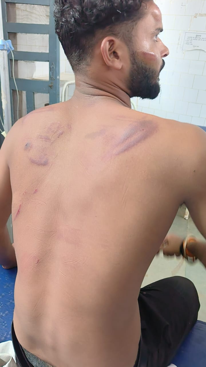 Janjgir News: रील्स बनाना युवकों को पड़ गया भारी, अज्ञात बदमाशों ने किया हमला, मामले की जांच में जुटी पुलिस