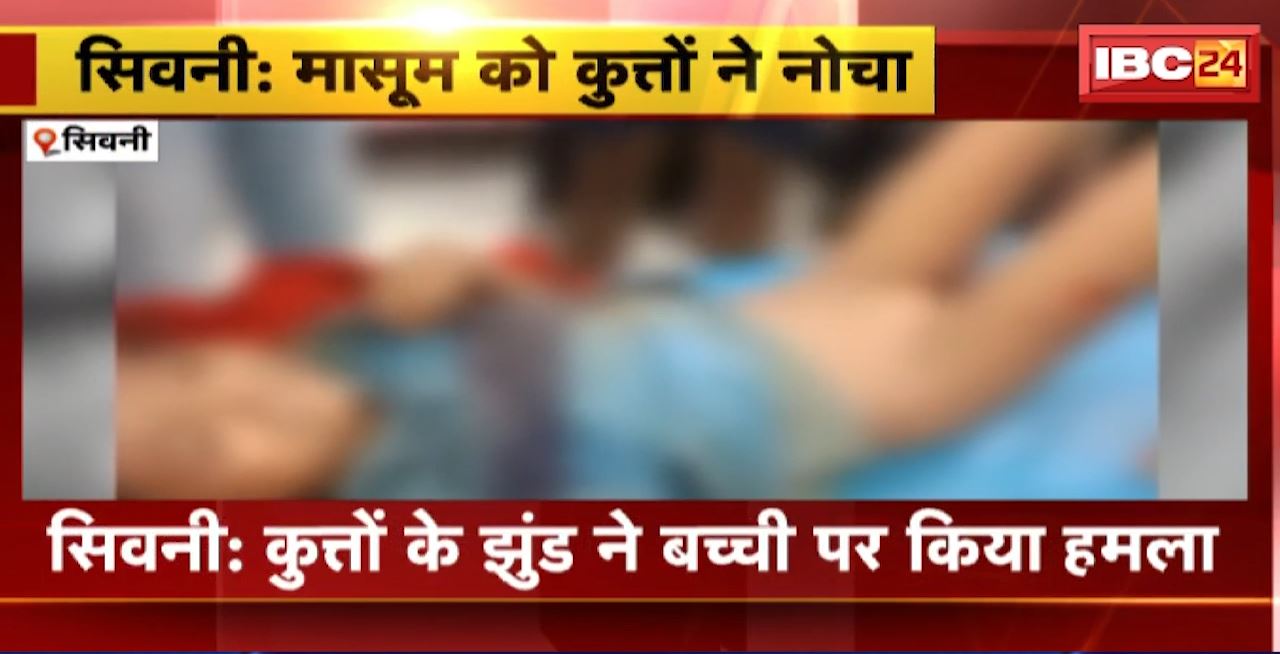 Dog Attack in Seoni : कुत्तों के झुंड ने बच्ची पर किया हमला। कुत्तों के हमले से बच्ची गंभीर घायल