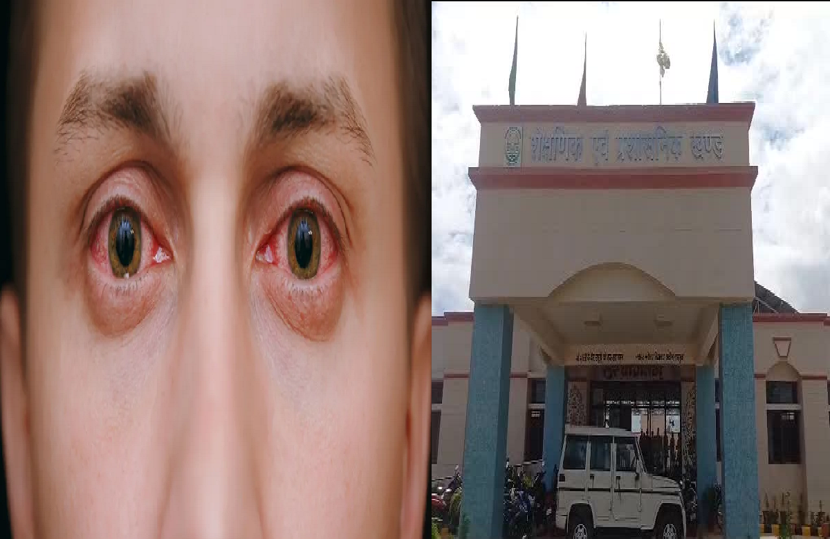 छत्तीसगढ़ के इस जिले में तेजी से पैर पसार रहा Eye Flu, नवोदय विद्यालय के 100 से ज्यादा बच्चे चपेट में आए, मचा हड़कंप