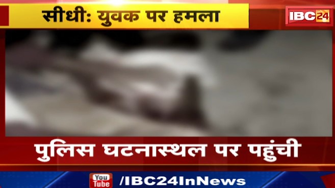 Sidhi में पिता और बेटे ने युवक पर किया हमला। युवक गंभीर घायल, अस्पताल में भर्ती। देखिए पूरा मामला..