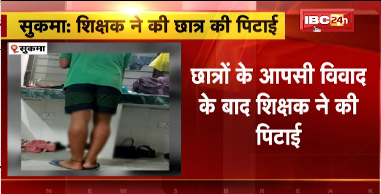सुकमा के नवोदय विद्यालय में शिक्षक ने की छात्र की पिटाई। छात्र के सिर और पैर में आई चोट। देखिए…