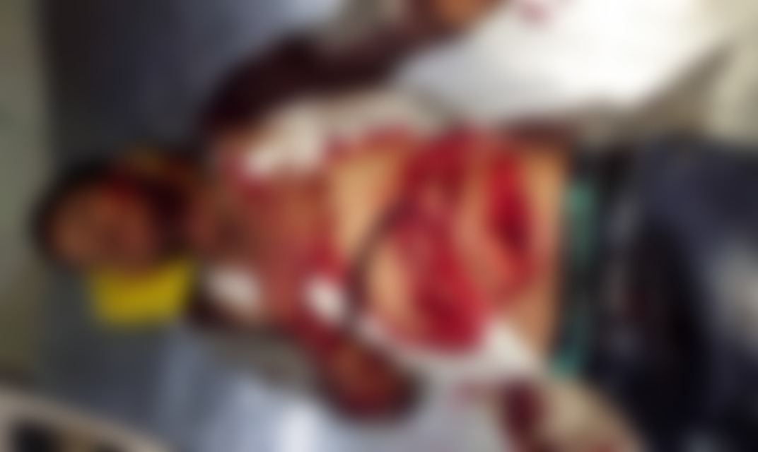 Gwalior News: माधौगंज थाना क्षेत्र में टमटम चालक पर अज्ञात व्यक्ति ने किया पेपर कटर से वार, सीसीटीवी कैमरे में कैद हुई तस्वीरें