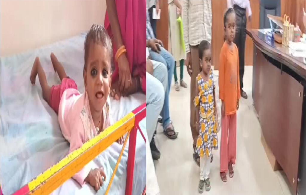 Panna district of Madhya Pradesh in grip of malnutrition