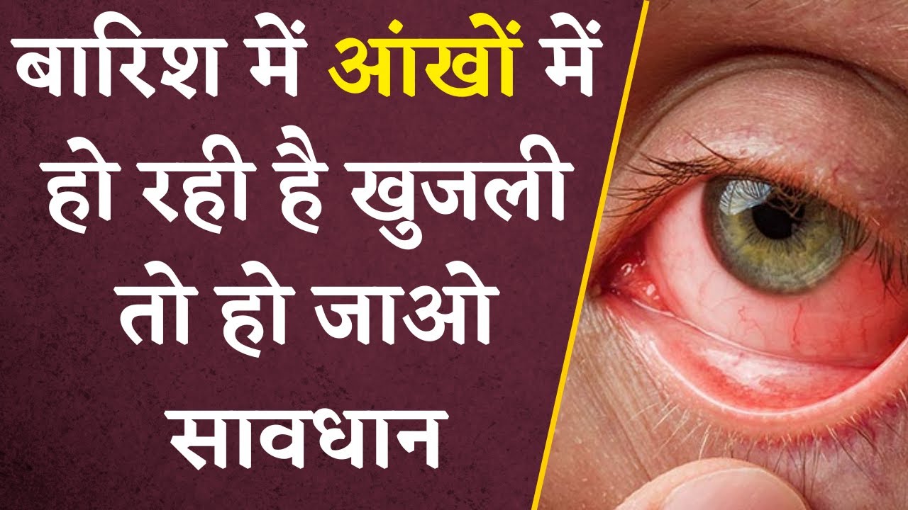 बारिश में आंखों में हो रही है खुजली तो हो जाओ सावधान, हो सकती है ये गंभीर समस्या | Khabar Bebak
