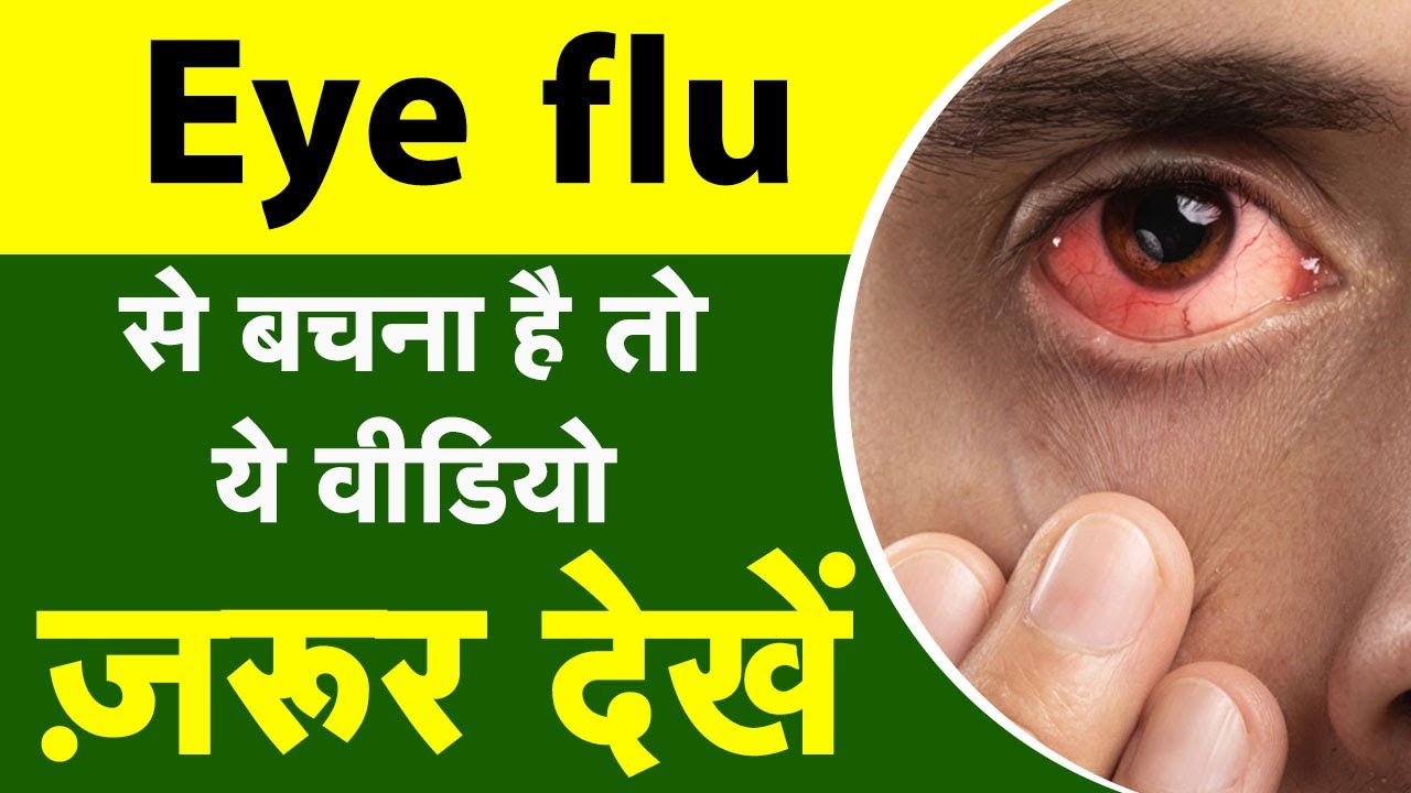 Eye flu से जरा बचकर !!!