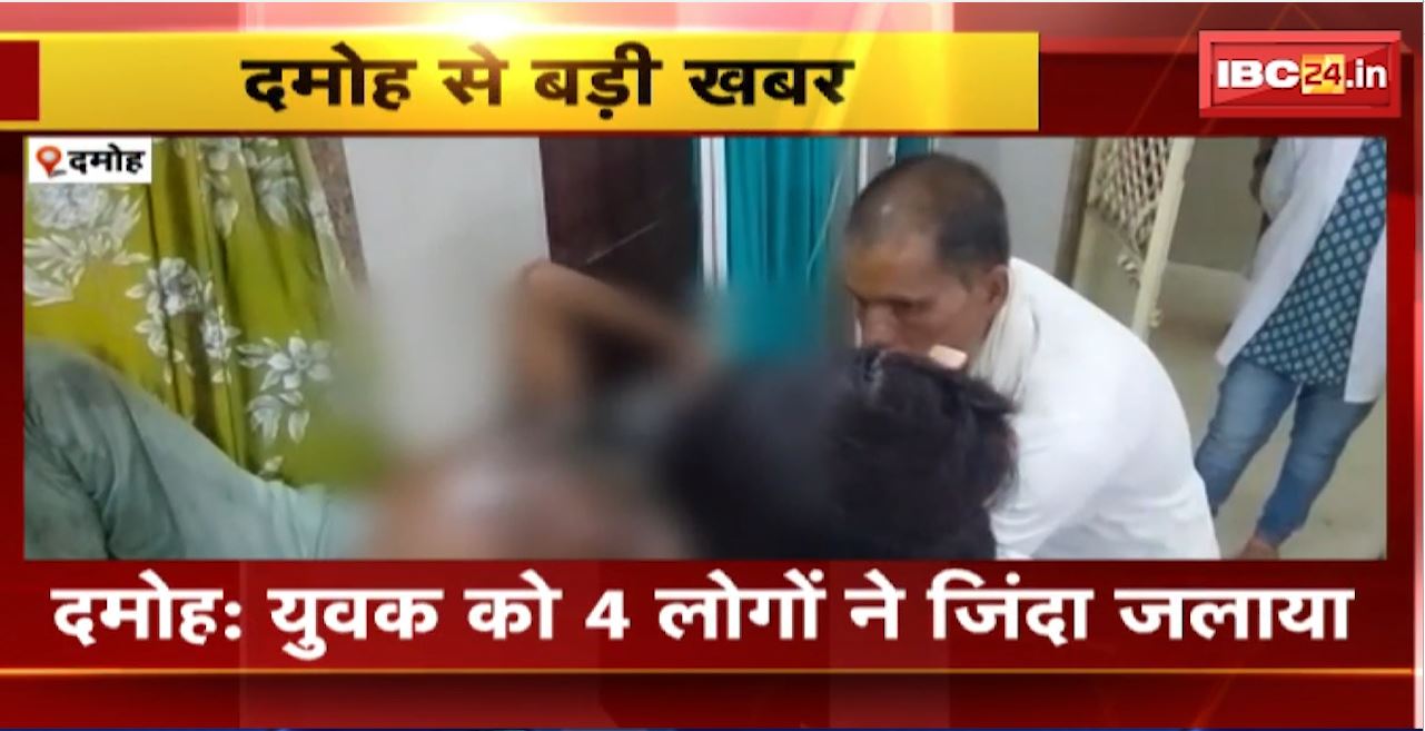 Damoh Crime News : 4 लोगों ने पेट्रोल डालकर युवक को जिंदा जलाया। युवक गंभीर रुप से झुलसा, अस्पताल में भर्ती
