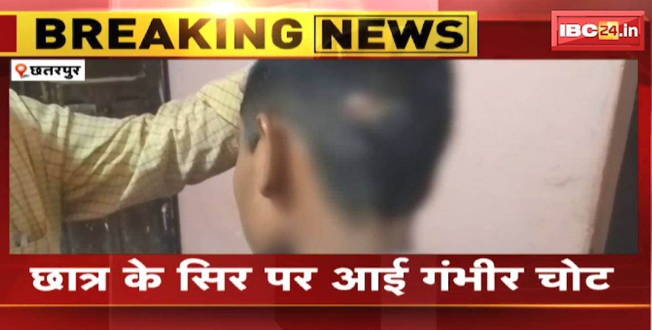 Chhatarpur News : शिक्षिका ने छात्र को डस्टर फेंककर मारा | छात्र के सिर पर आई गंभीर चोट