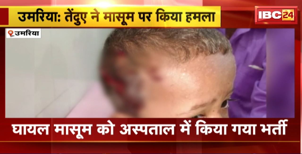 Umaria Leopard Attack : तेंदुए ने मासूम पर किया हमला। घायल मासूम को अस्पताल में किया गया भर्ती