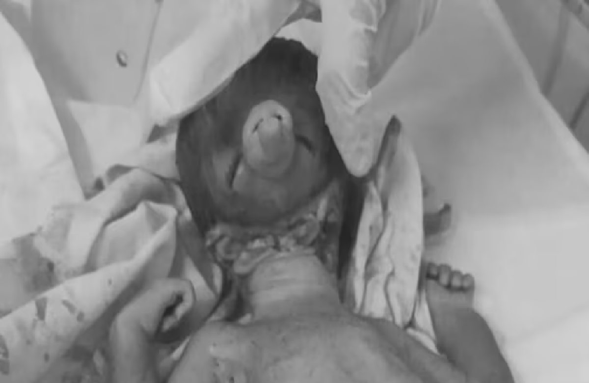 यहां ‘गणपति’ की शक्ल वाले बच्चे ने लिया जन्म, देखकर डॉक्टरों के भी उड़ गए होश 