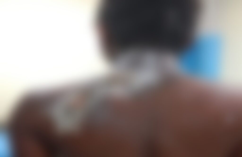 ACB power plant accident