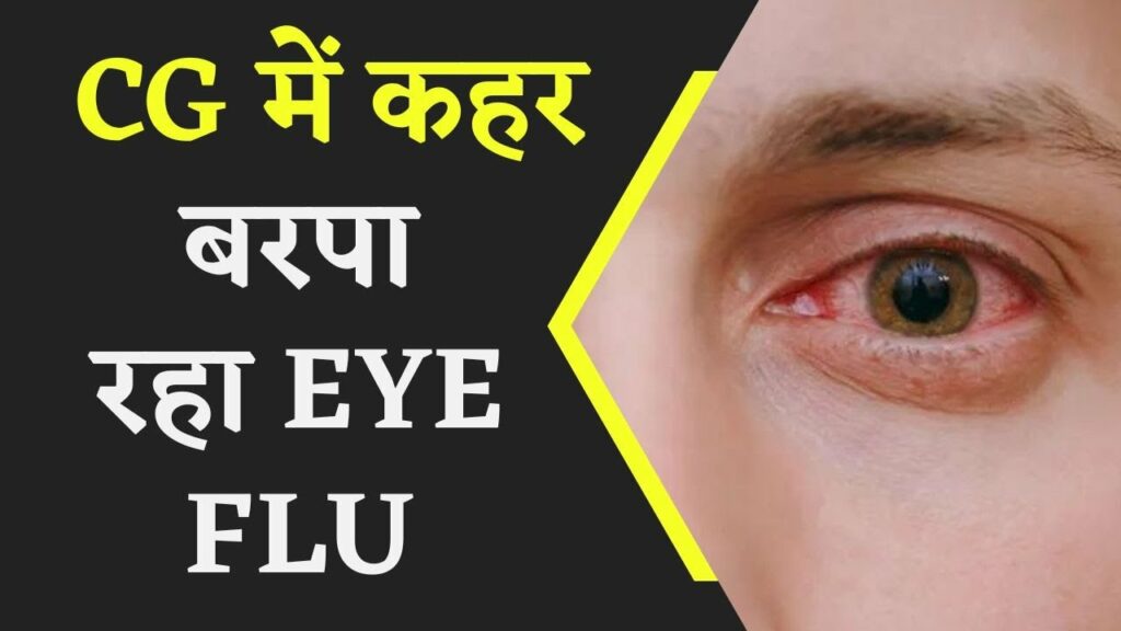 Eye flu in chhattisgarh