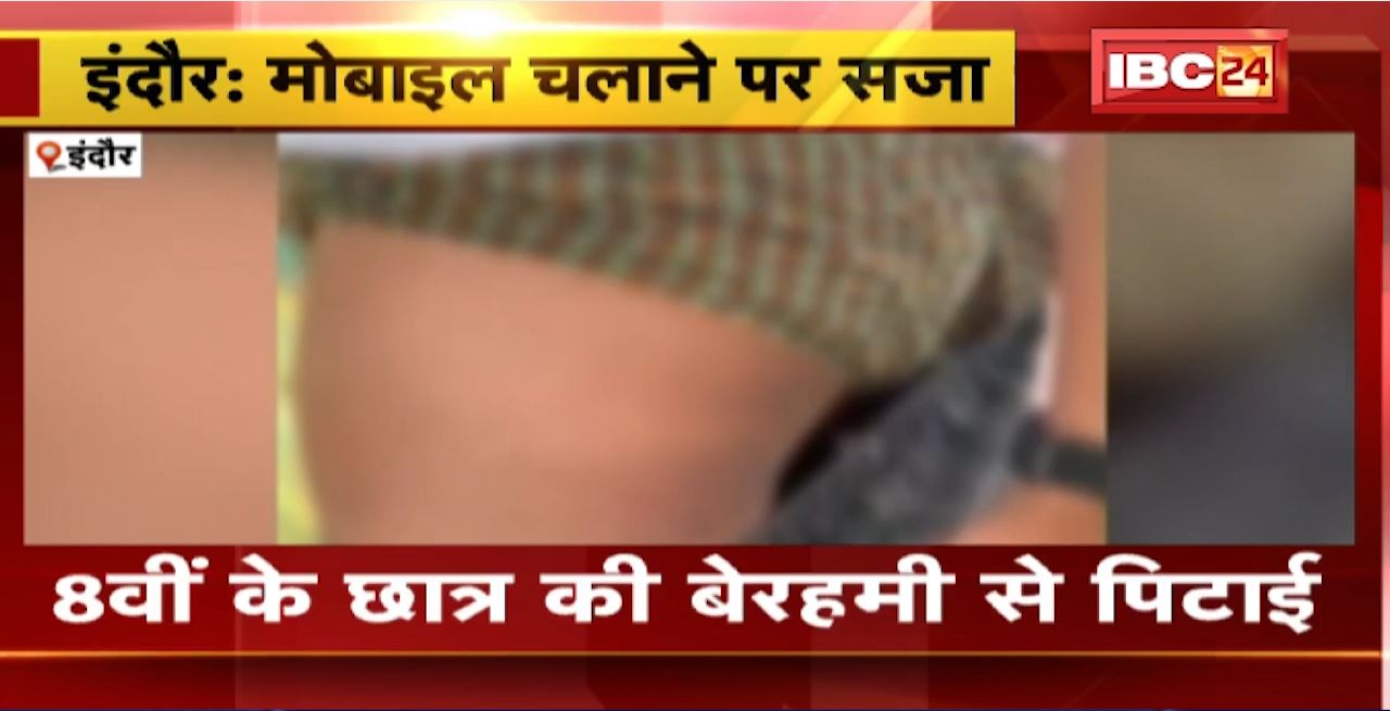Indore में 8वीं के छात्र की बेरहमी से पिटाई। Hostel में नाराज वार्डन ने की छात्र की पिटाई। देखिए क्या है पूरा मामला