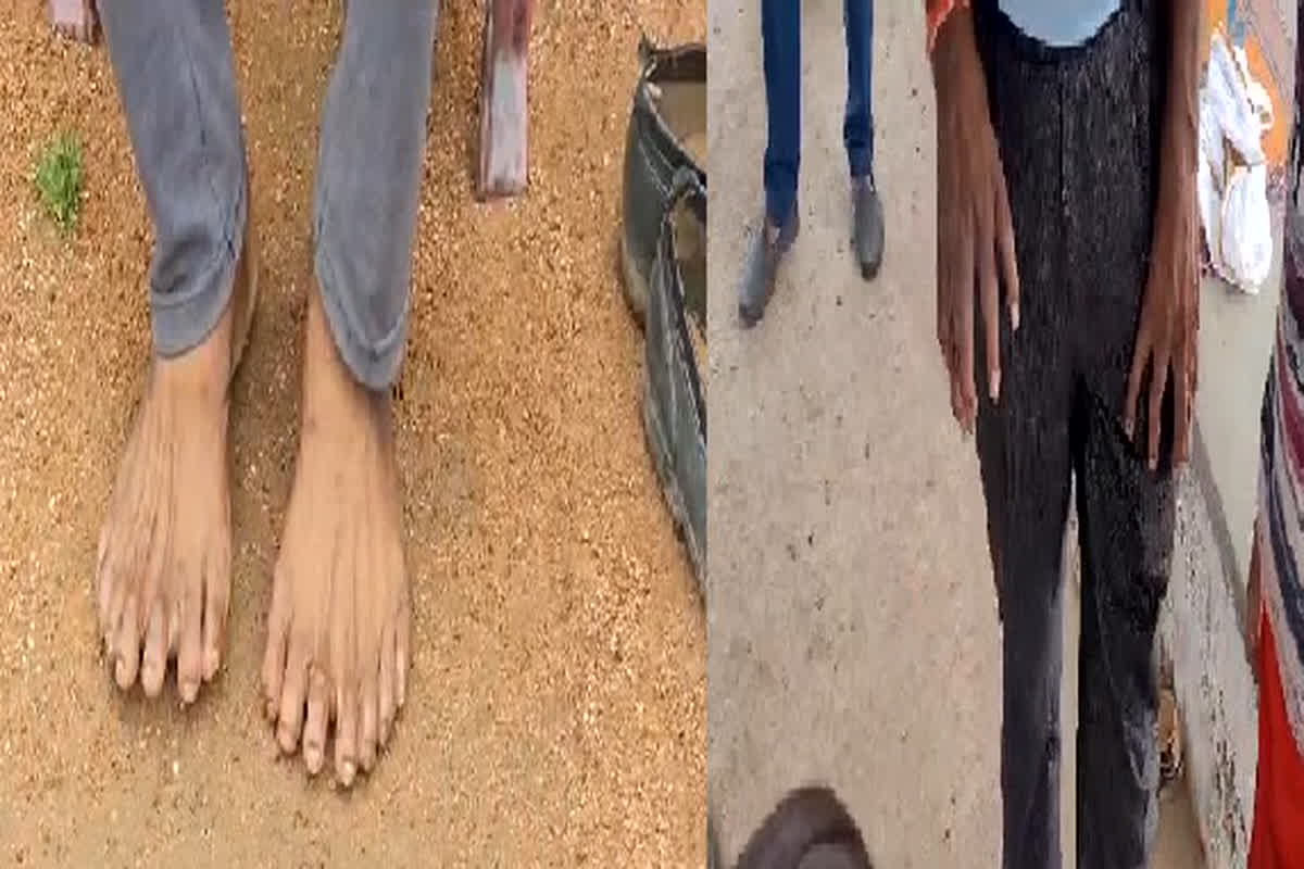 Chhatarpur News: इस परिवार के सदस्य पीड़ियों से हैं अजीब विकृति से ग्रसति, सभी के हाथ पैरों में है 27 उंगलियां