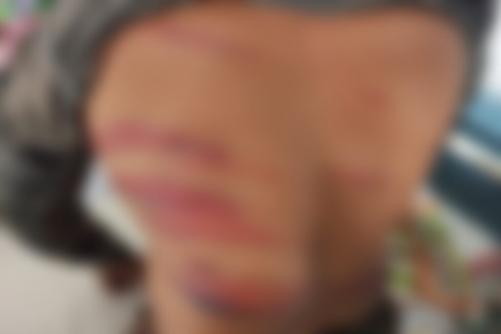 Miscreants beat up disabled youth