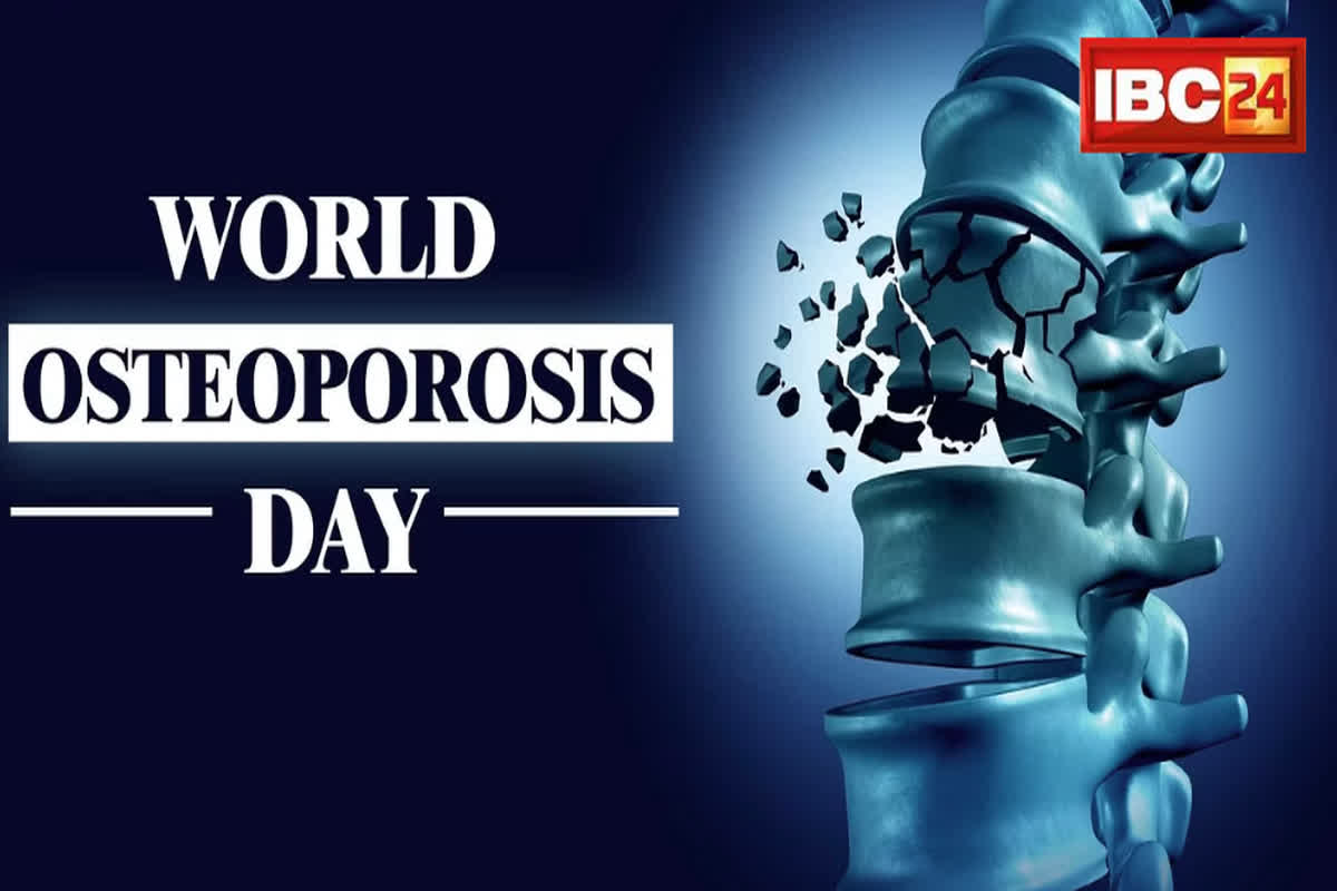 World Osteoporosis Day: हड्डियों की मजबूती के लिए बेहद जरूरी होते हैं ये दो विटामिन्स, न करें नजर अंदाज, वरना ना रहेगा ढांचा और ना रहेंगे दांत…